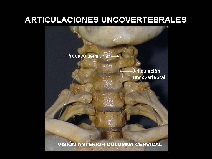 Articulaciones Cráneo Cervicales Universidad De Los Andes